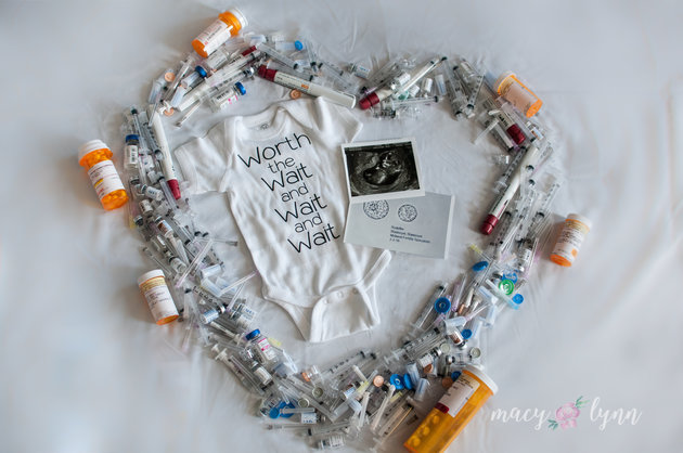 Mom Celebrates Rainbow Baby With IVF-Themed Pregnancy Announcement